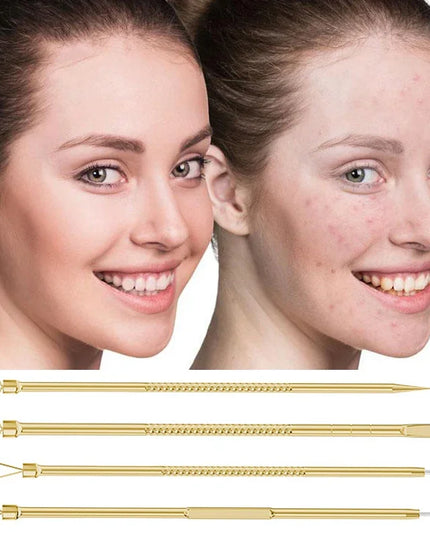 9/7/5PCS Acne Blackhead Removal Needles Kits Gold Color Stainless Steel Black Spot Blemish Pimple Cleansing Tool Face Skin Care