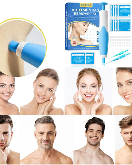2 IN 1 Auto Micro Skin Tag Remover Device Standard And Micro Skin Tag Removal Kit Adult Mole Wart Remover Face Care Beauty Tools
