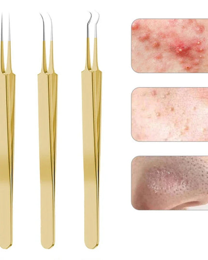 9/7/5PCS Acne Blackhead Removal Needles Kits Gold Color Stainless Steel Black Spot Blemish Pimple Cleansing Tool Face Skin Care