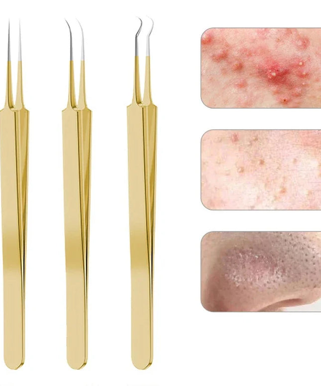 9/7/5PCS Acne Blackhead Removal Needles Kits Gold Color Stainless Steel Black Spot Blemish Pimple Cleansing Tool Face Skin Care