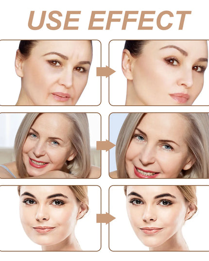 2.5CM*5M Instant Facial Myofascial Lift Tape For Face Neck Eyes Skin Lifting Tool Wrinkle Removal Sticker V Face Elastic Bandage