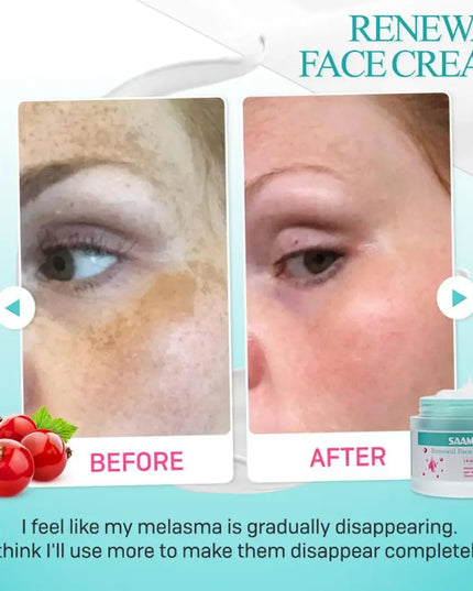 Saam Face Cream，Saam Renewal