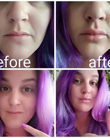 Silicone Labium Fish Shape Lips Tools Women Sexy Lip Plumper Enhancer Tool for Female Girls Natural Pout Thicken Mouth Plump