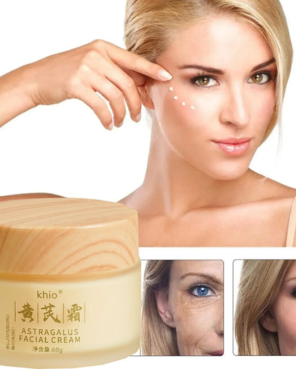Chinese Astragalus Whitening Freckles Cream Remove Anti-aging Spot Face Care Dark Melasma Lightening Dry Moisturizing Brigh