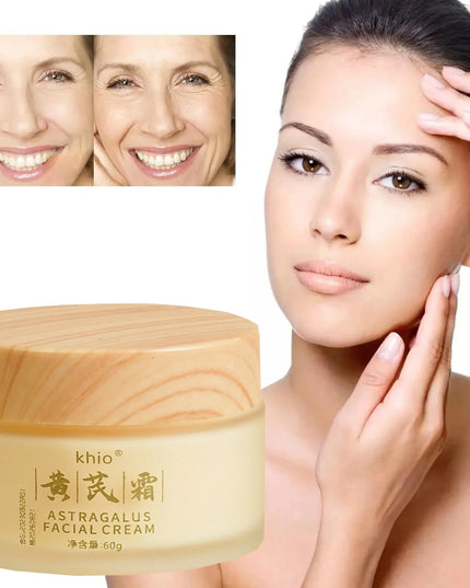 Chinese Astragalus Whitening Freckles Cream Remove Anti-aging Spot Face Care Dark Melasma Lightening Dry Moisturizing Brigh