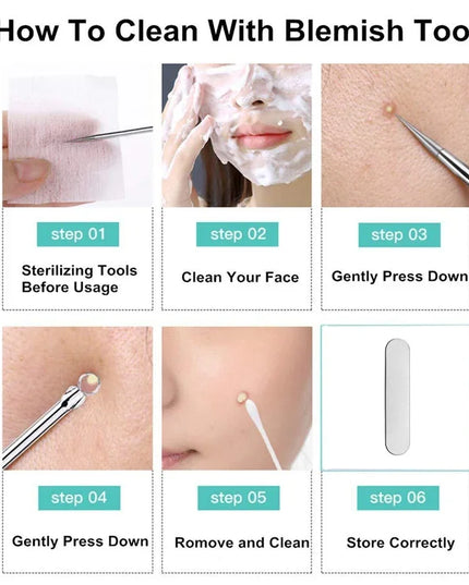 9/7/5PCS Acne Blackhead Removal Needles Kits Gold Color Stainless Steel Black Spot Blemish Pimple Cleansing Tool Face Skin Care