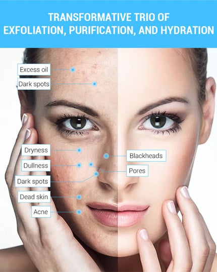 3 IN 1 Diamond Microdermabrasion hydra diamond Beauty Machine Water Spray Suction Blackhead Exfoliation Face Peeling Skin Tools