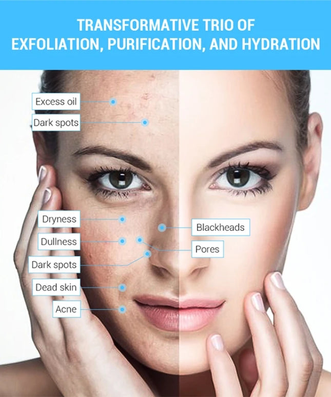 3 IN 1 Diamond Microdermabrasion hydra diamond Beauty Machine Water Spray Suction Blackhead Exfoliation Face Peeling Skin Tools