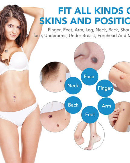 Skin Tag Removal Device Face Beauty Accessories Rubber Rings Wart Tag Remover Kit Multipurpose Supplies for Face Neck Chin Back