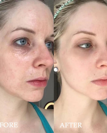 Korea DIY Miracle Face Mask Peptide Hyaluronic Acid Essence Kit Repair Face Lifting Firming Brightening Fine Lines Skin Care