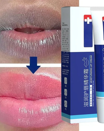Lip serum cream, lightens lip lines, brightens lip color, moisturizes and moisturizes treatment