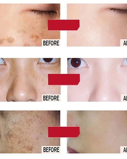 AILKE Lightening Facial Cream, Brightening, Reduce Spots, For Black and Dark Skin, Whitening Face Care Set for All Skin Types